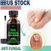 Toenail And Fingernail Fungus Treatment Extra Strength Antifungal Athletes Foot