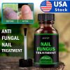 Toenail And Fingernail Fungus Treatment Extra Strength Antifungal Athletes Foot